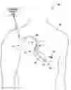 Fig. 01 - Implanted electrode configuration for physiological sensing and tissue conductance communication