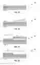 Fig. 07 - Implanted electrode configuration for physiological sensing and tissue conductance communication