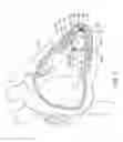 Fig. 02 - Delivery devices and methods for leadless cardiac devices