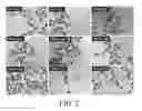 Fig. 04 - Therapy for glioblastoma multiforme
