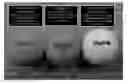 Fig. 01 - GOLF BALL HAVING MATTE SURFACE WITH IMPROVED VISIBILITY