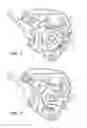 Fig. 04 - Lift assist lock-down for a soft top