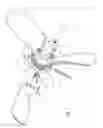 Fig. 06 - Surfboard booster system