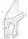 Fig. 06 - Selectable barrier filtration system