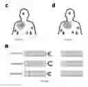 Fig. 22 - PROGRAMMABLE, SELF ASSEMBLING PATCHED NANOPARTICLES, AND ASSOCIATED DEVICES, SYSTEMS AND METHODS