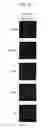 Fig. 13 - Host regulatory factor that enhances replication and/or propagation of vaccinia virus