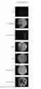 Fig. 15 - Host regulatory factor that enhances replication and/or propagation of vaccinia virus