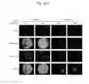 Fig. 20 - Host regulatory factor that enhances replication and/or propagation of vaccinia virus