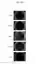 Fig. 25 - Host regulatory factor that enhances replication and/or propagation of vaccinia virus