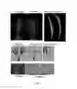 Fig. 04 - Rice mitochondrial sterile gene and application thereof