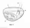 Fig. 02 - Method of relieving stress from face plate welds of a golf club head