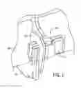 Fig. 02 - Rebar clamp assembly with clip