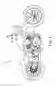 Fig. 02 - SYSTEM AND METHOD FOR POSITIONING AN INSERT IN AN ENGINE