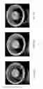 Fig. 02 - Composite suction liners and applications thereof