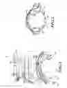 Fig. 02 - Electro-hydraulic limited slip differential system