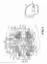 Fig. 03 - Electro-hydraulic limited slip differential system