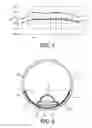 Fig. 04 - Lighting device, luminaire and lighting device assembly method