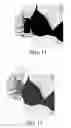 Fig. 06 - Apparatus and related methods of measuring breast cup size for garments that support breast