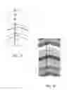 Fig. 09 - Apparatus and related methods of measuring breast cup size for garments that support breast