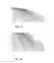 Fig. 12 - Apparatus and related methods of measuring breast cup size for garments that support breast
