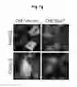 Fig. 22 - Modulation of hepatitis B virus replication