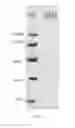 Fig. 04 - Preparation method of Cryptococcus neoformans capsular polysaccharide GXM as well as GXM antigen immunoassay kit and application thereof