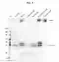 Fig. 04 - Lp-PLA2 assays and composition with detergent