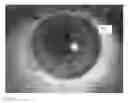 Fig. 04 - Contact lens using indicia to aid fitting
