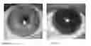 Fig. 08 - Contact lens using indicia to aid fitting