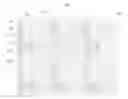 Fig. 01 - LIQUID CRYSTAL PANELS, LIQUID CRYSTAL ALIGNMENT METHODS THEREOF AND LIQUID CRYSTAL DISPLAYS