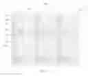 Fig. 03 - LIQUID CRYSTAL PANELS, LIQUID CRYSTAL ALIGNMENT METHODS THEREOF AND LIQUID CRYSTAL DISPLAYS
