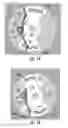 Fig. 08 - Self-centering spring return mechanism for an appliance knob