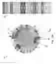 Fig. 16 - METHOD AND SYSTEM FOR PREDICTING REFRACTORY EPILEPSY STATUS