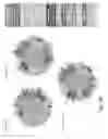 Fig. 17 - METHOD AND SYSTEM FOR PREDICTING REFRACTORY EPILEPSY STATUS