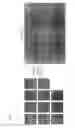Fig. 03 - Electron channeling pattern acquisition from small crystalline areas