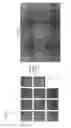 Fig. 03 - Electron channeling pattern acquisition from small crystalline areas