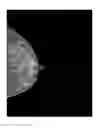 Fig. 01 - Method and device for generating 2D medical image based on plate interpolation