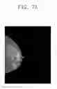 Fig. 07 - Method and device for generating 2D medical image based on plate interpolation