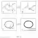 Fig. 13 - Method and system for acquiring status of strain and stress of a vessel wall