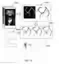 Fig. 17 - Method and system for analyzing blood flow condition
