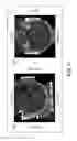 Fig. 17 - System, method and computer readable medium for quantifying anatomical device deformation under load