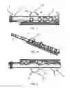 Fig. 02 - Flute with enhanced flute-finger connection