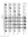 Fig. 06 - Stacked semiconductor device