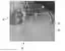 Fig. 01 - Assistance device and method for an interventional hemodynamic measurement