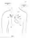 Fig. 02 - Recharge of implanted medical devices
