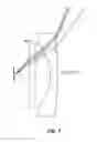 Fig. 09 - Endoscope employing structured light providing physiological feature size measurement