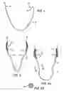 Fig. 03 - Cleavage enhancing undergarment system