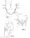 Fig. 04 - Cleavage enhancing undergarment system