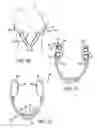 Fig. 05 - Cleavage enhancing undergarment system