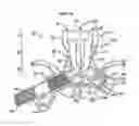 Fig. 04 - Grip assist apparatus with insert